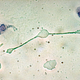 Image for article titled What Happens When You Get The Wrong Blood Type?